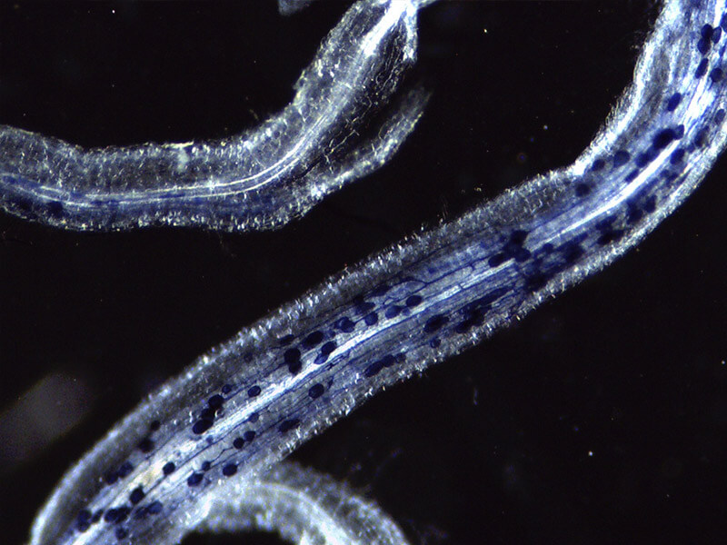 Stained plant roots as seen under a microscope.