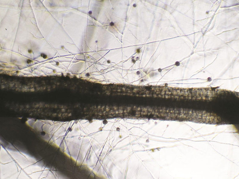 Mychorizes au microscope