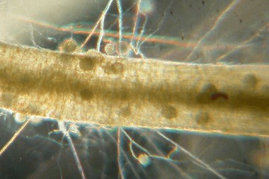 Vista microscópica de una raíz de micorrizas