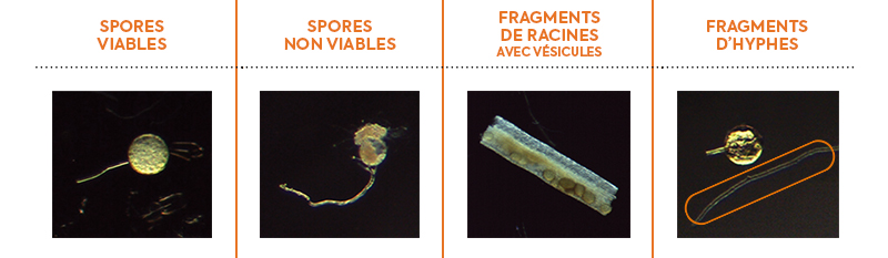 Mycorhizes vues au microscope