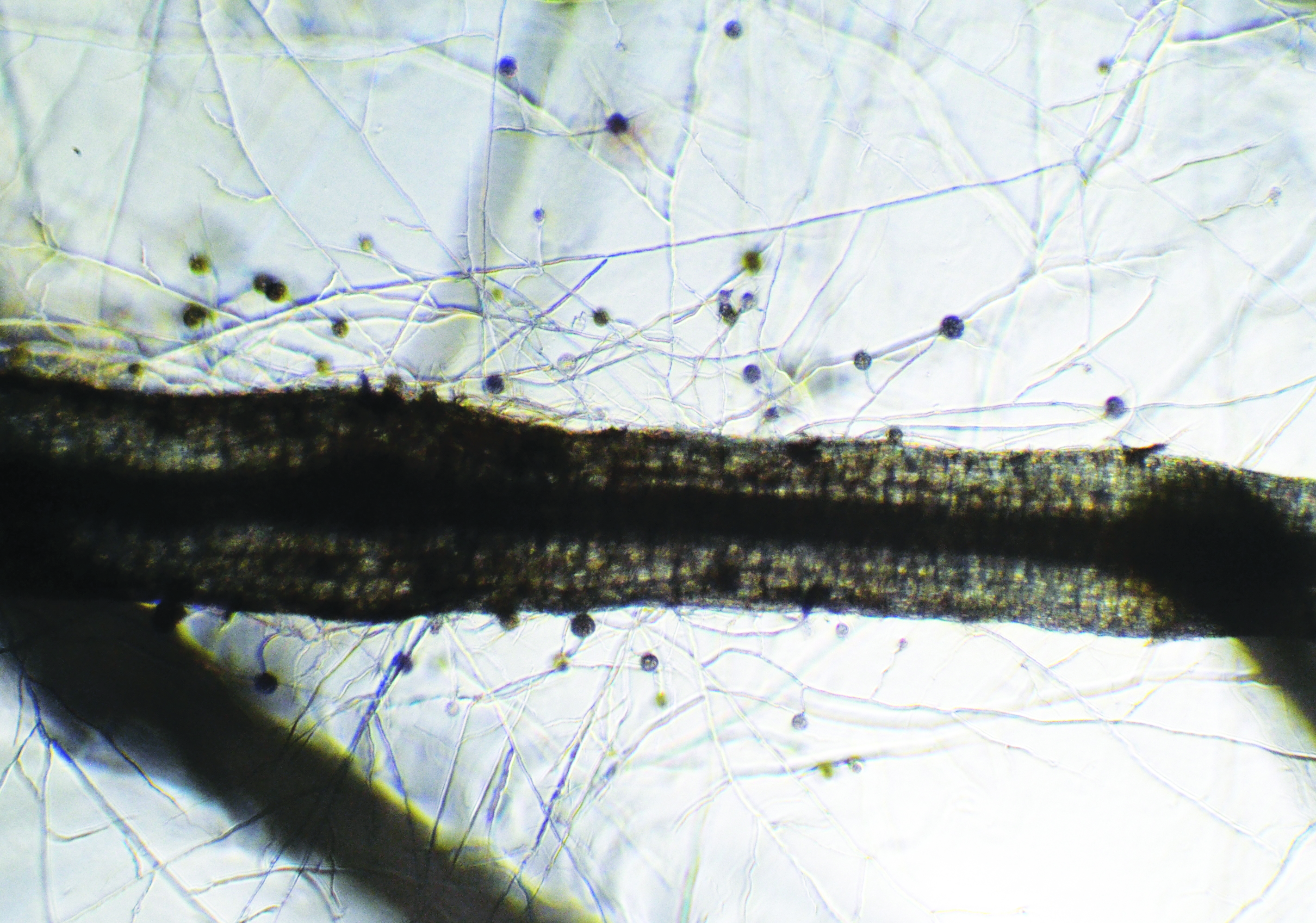 Mycorrhizae