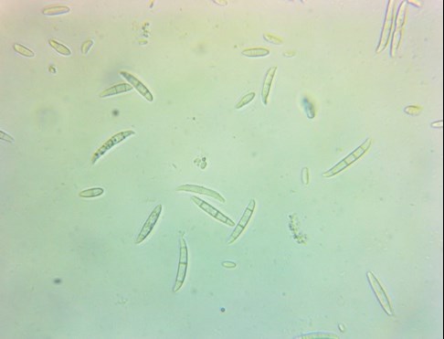 fusarium