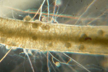 Article fr-ca| Microscopic view of a mycorrhizal root Vue microscopique d'une racine mycorhizee