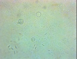 pythium