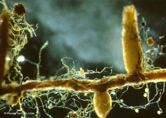 Microscope view of endomycorrhizae Microscope view of endomycorrhizae