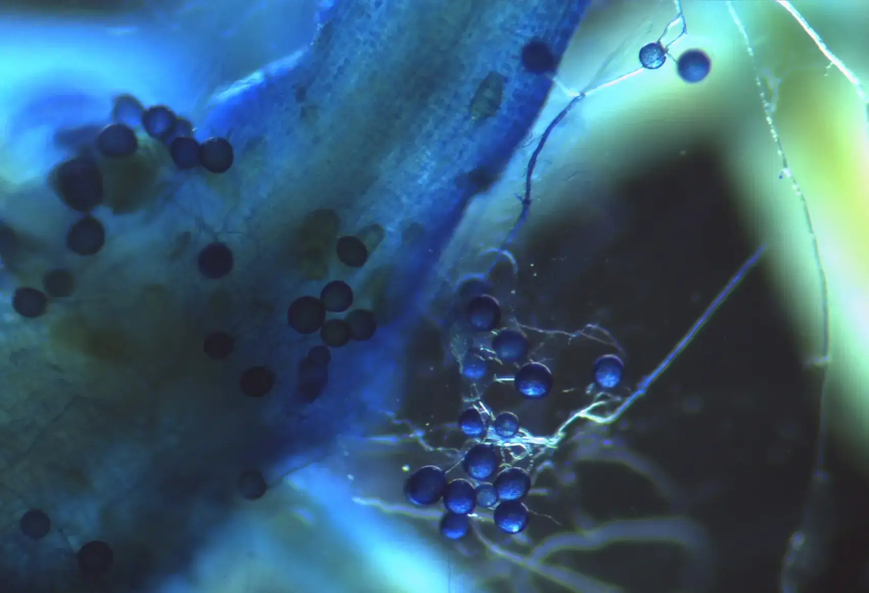 Intra and extra-root spore stained with Cotton Blue