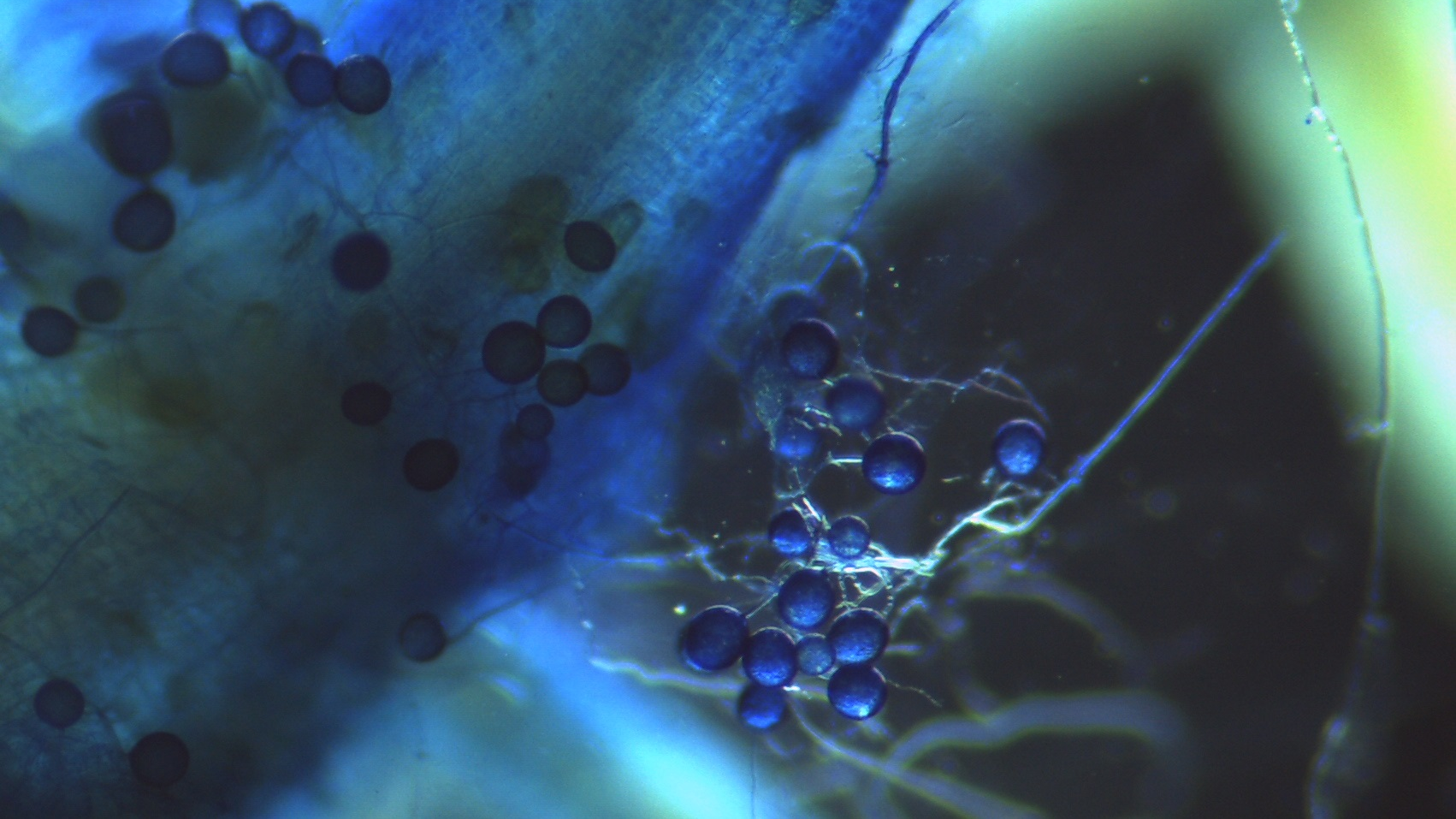 Intra and extra-root spore stained with Cotton Blue
